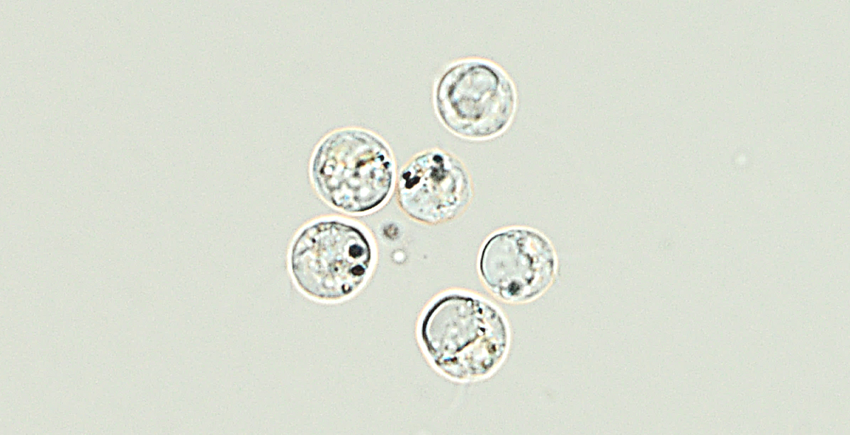 Le nano-argent perturbateur biologique avéré